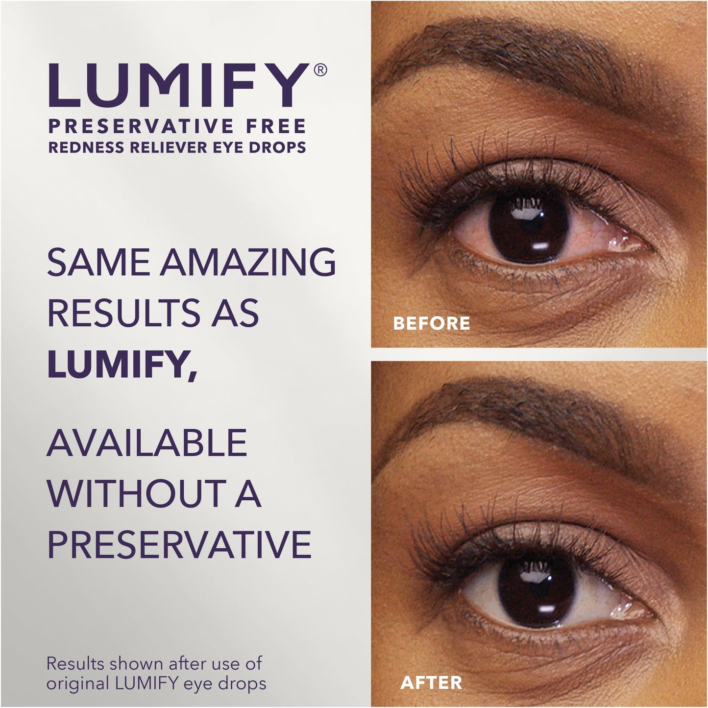 LUMIFY Redness Reliever Eye Drops, For Whiter & Brighter Looking Eyes, 0.25 Fl Oz (7.5 mL)